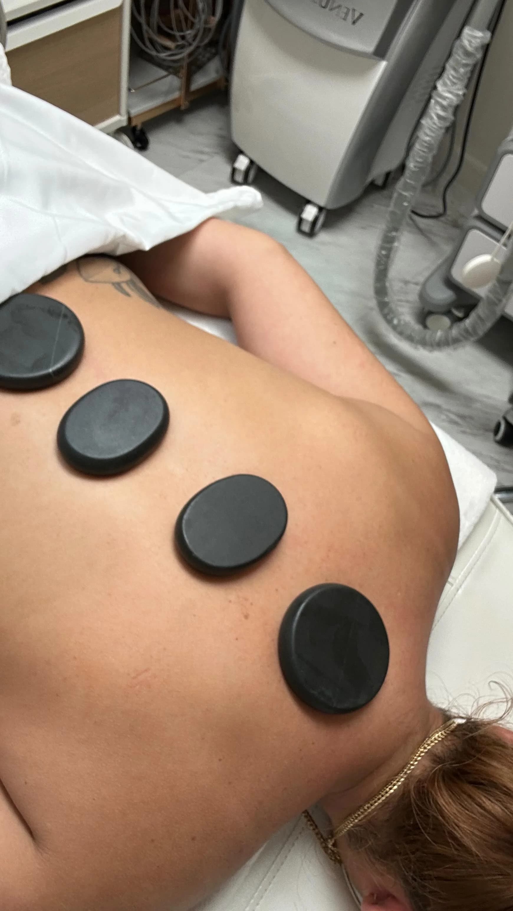 Hot stone therapy